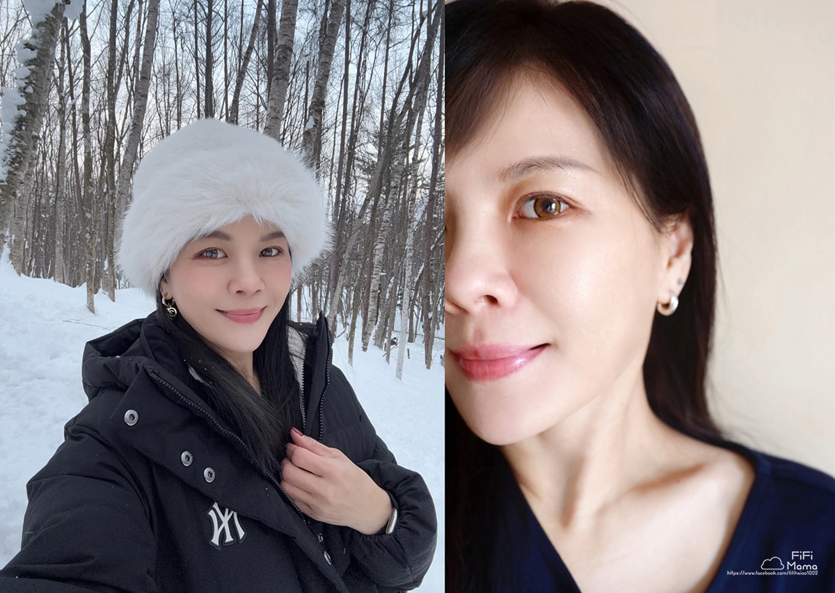 韓國醫美｜江南ON奧恩皮膚科｜鈦提升「鈦」有感！非流水線+院長親面診